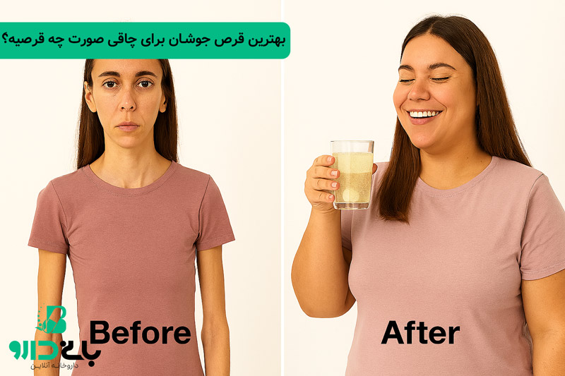 بهترین قرص جوشان برای چاقی صورت چیه؟